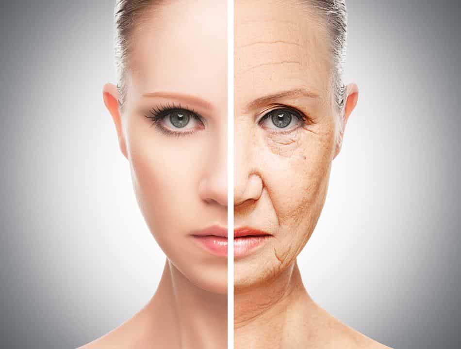 Facelift-Surgery-Wrinkle-Free-Face