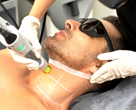best_laser_hair_removal_in_chennai