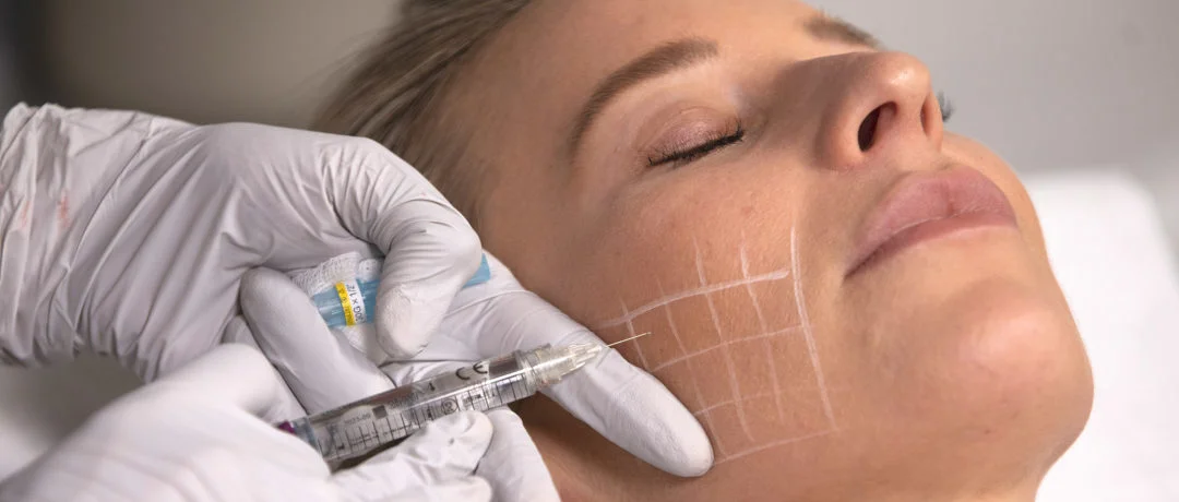 skin-boosters